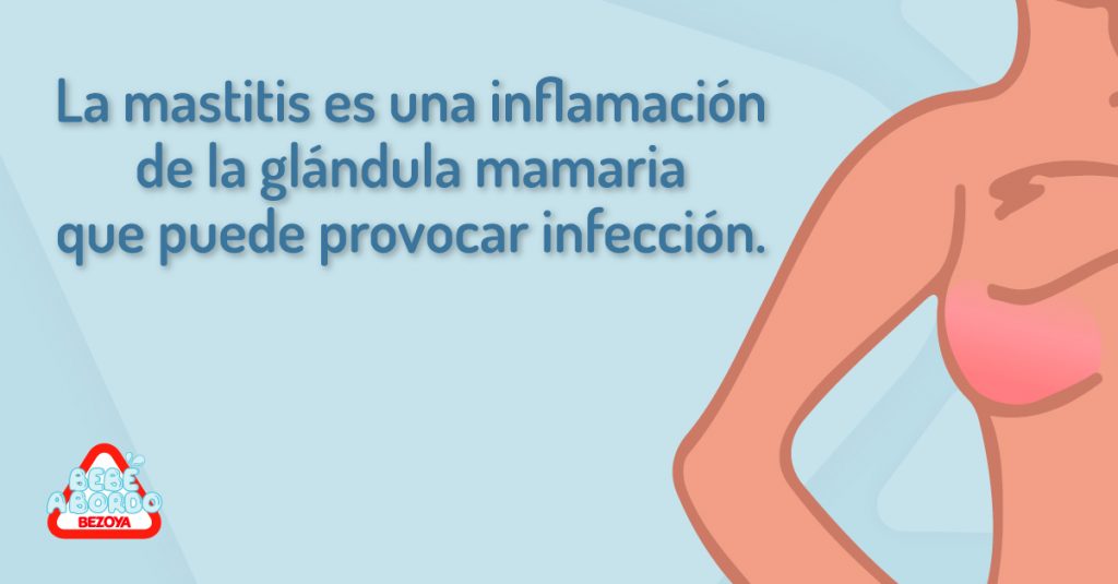 La mastitis es una inflamación de la glándula mamaria