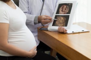 Embarazo Ectópico: Causas, Síntomas y Consejos prácticos